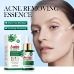Sadoer Tea Tree Oil Control Anti-Acne Serum Essence 30ml - Image 2